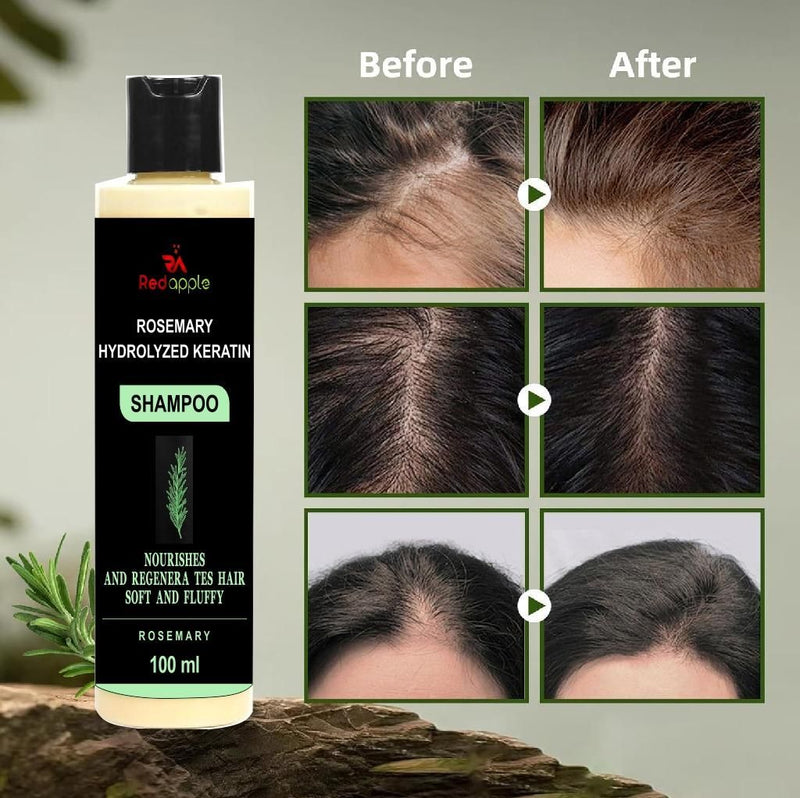 🌿 Rosemary Hydrolyzed Keratin Shampoo 100ml – Buy 1 Get 1 Free (Pack of 2) | Strong, Smooth & Healthy Hair