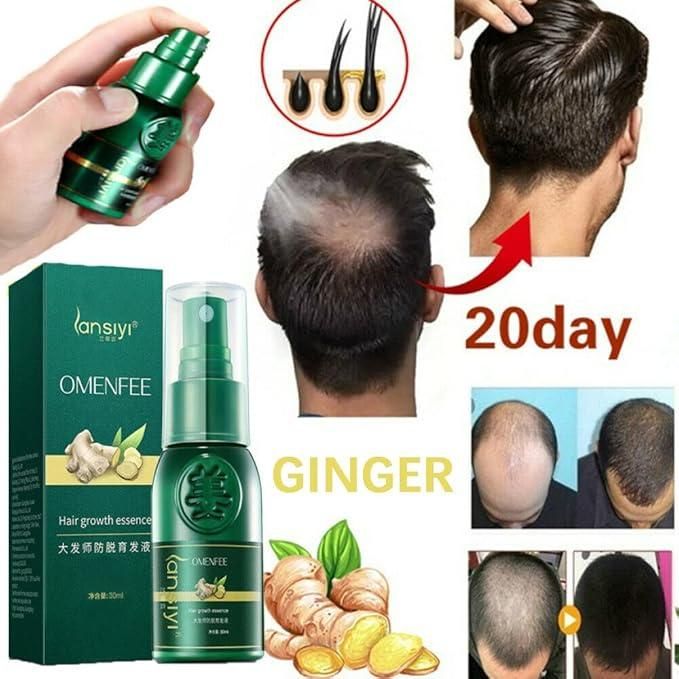 "Japanese Hair Growth Spray 100ml – Buy 1 Get 1 Free | Pack of 2 | Stronger, Thicker & Healthier Hair"
