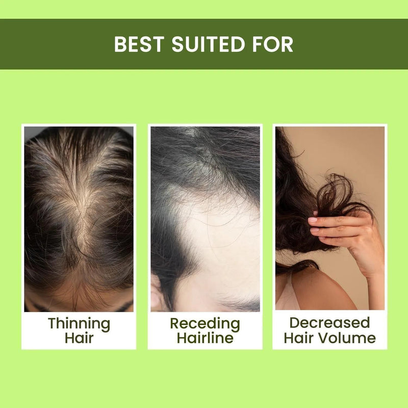 🌿 100% Natural Rosemary Hair Spray – Strengthen Hair Roots, Prevent Hair Fall, Boost New Growth, Nourish & Revitalize Hair Naturally | Herbal Hair Care Solution | Buy 1 Get 2 Free Offer (200ml) Per Pic