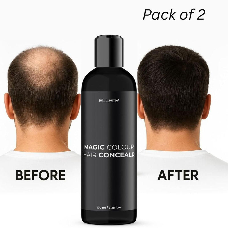 ELLHOY Magic Colour Hair Concealer Spray 100ml – Buy 1 Get 1 Free (Pack of 2) | Instant Grey Hair Cover & Root Touch-Up