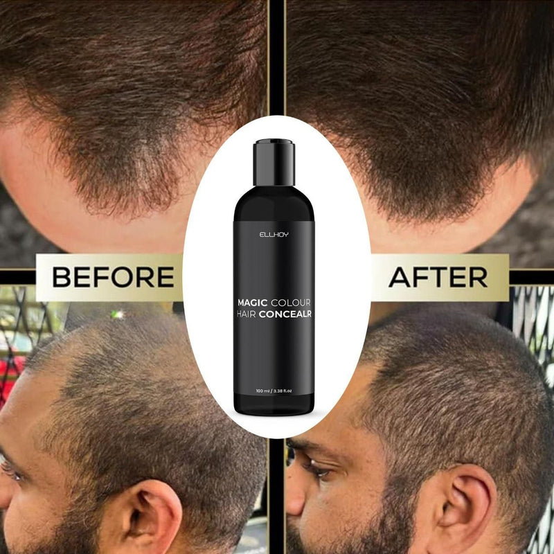 ELLHOY Magic Colour Hair Concealer Spray 100ml – Buy 1 Get 1 Free (Pack of 2) | Instant Grey Hair Cover & Root Touch-Up