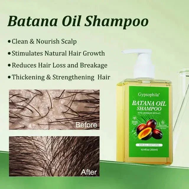 Batana Oil Shampoo for Hair Growth 300ml - Himalaya Life Care