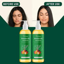 BATANA OIL SHAMPOO (Pack of 2) - Himalaya Life Care