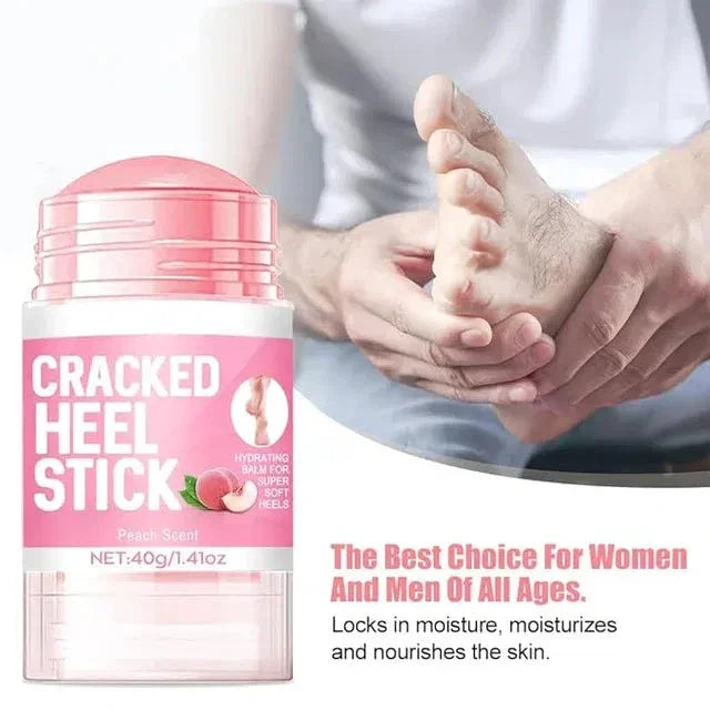 Cracked Heel Repair Cream – Deep Moisturizing & Fast-Healing Foot Care 19384