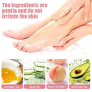 Cracked Heel Repair Cream – Deep Moisturizing & Fast-Healing Foot Care 19384