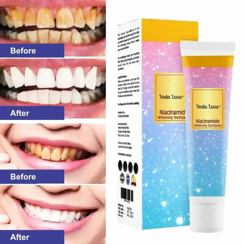 Natural Teeth Whitening Toothpaste Pack of 2 with Niacinamide