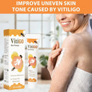 Vitiligo Correcting Cream with bee venom, designed for uneven skin tone caused by vitiligo, displayed with packaging.