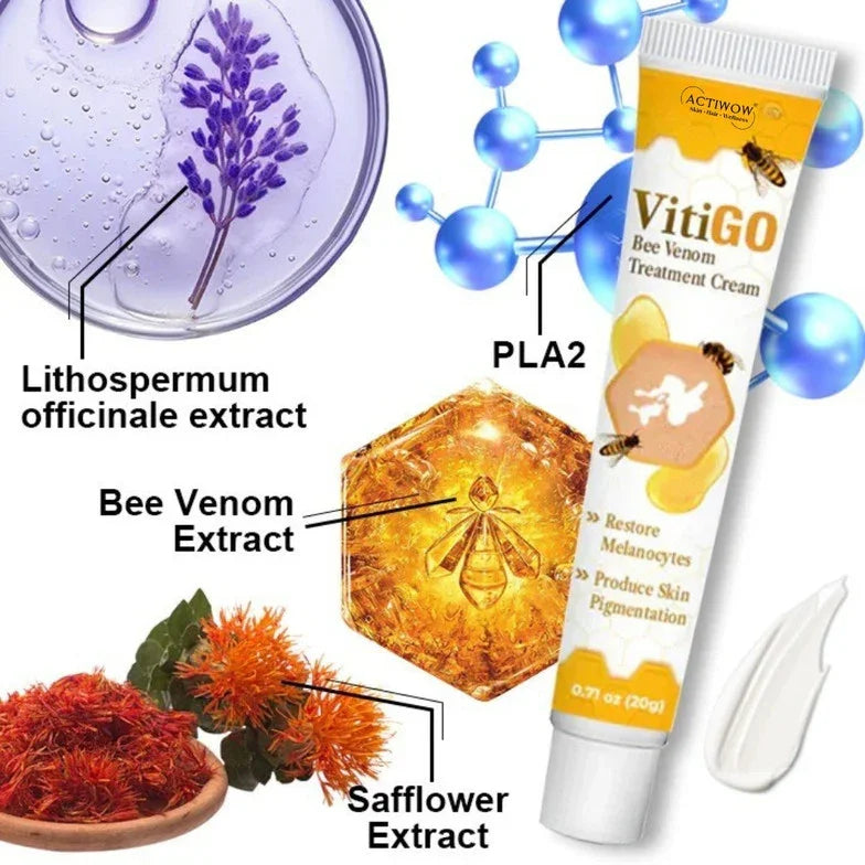 Vitigo Bee Venom Treatment Cream with extracts including Lithospermum, PLA2, and Safflower for skin rejuvenation.