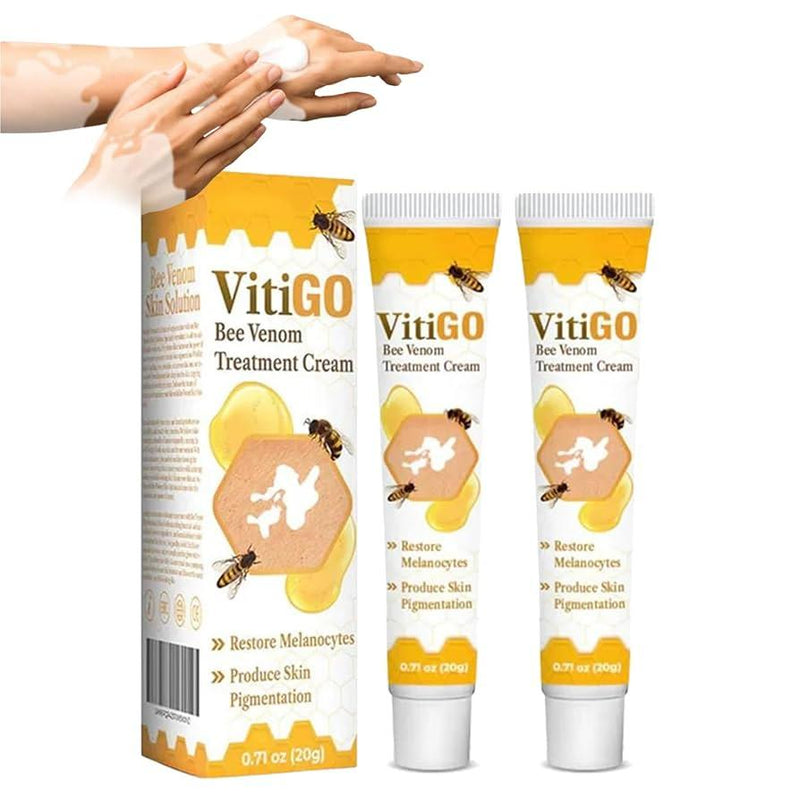 Vitigo Correcting Cream pack of 2 tubes with packaging, effective solution for skin pigmentation.
