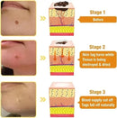 Zidella Skin  Lightening Cream 50g (Pack of 2) - Himalaya Life Care