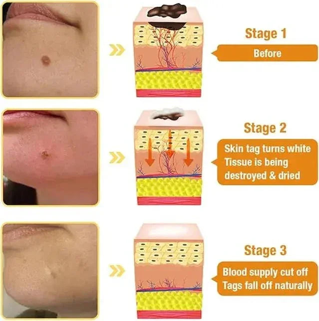 Zidella Skin  Lightening Cream 50g (Pack of 2) - Himalaya Life Care